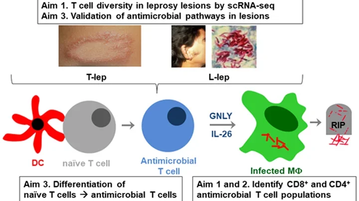 Schematic diagram illustrating a study on the diversity and function of T cells in leprosy lesions. Details on page.